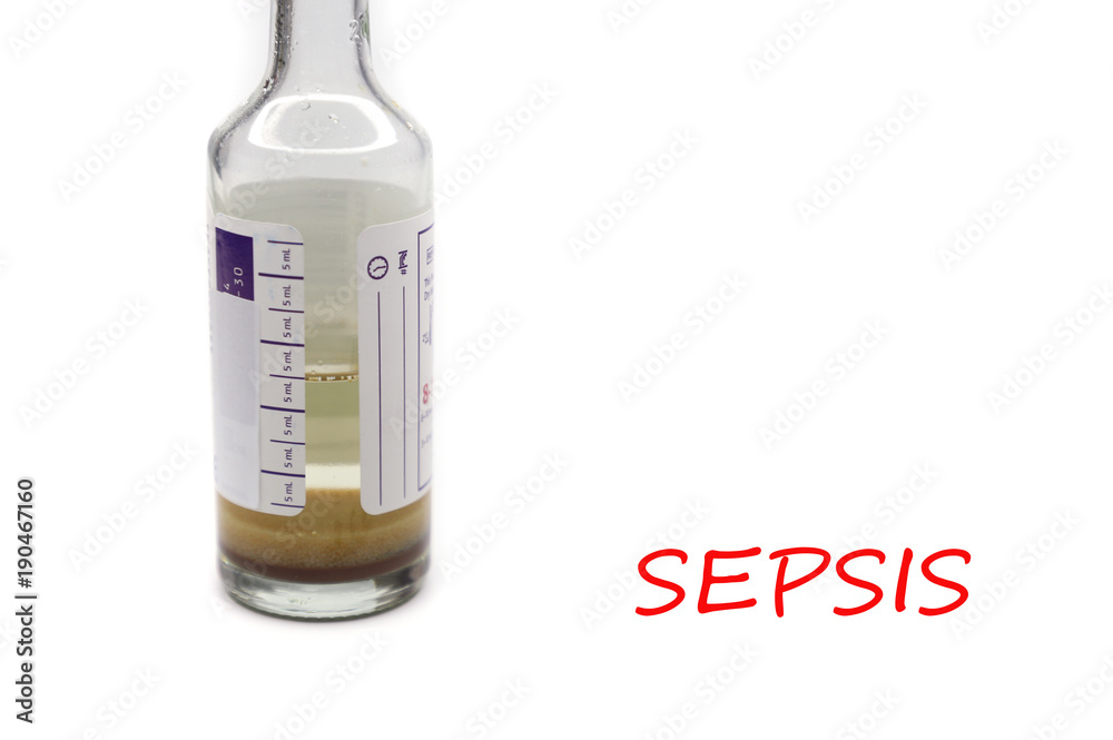 Sepsis Workup