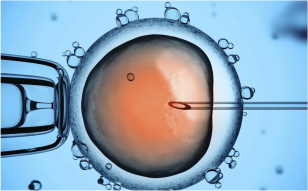 sperm injection